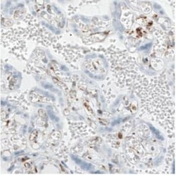 LYRIC Antibody (CL0401), Novus Biologicals:Antibodies:Primary Antibodies