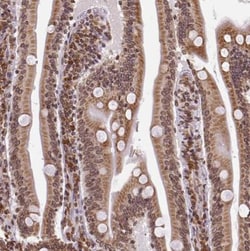 LYRIC Antibody, Novus Biologicals:Antibodies:Primary Antibodies