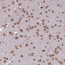 LYRIC Antibody, Novus Biologicals:Antibodies:Primary Antibodies