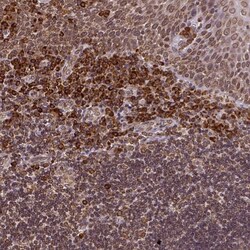 LYRIC Antibody, Novus Biologicals:Antibodies:Primary Antibodies