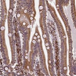 LYRIC Antibody, Novus Biologicals 0.1mL; Unlabeled:Antibodies, Polyclonal