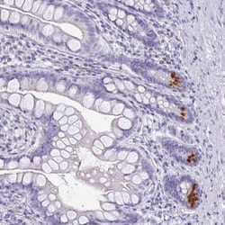 LYRM2 Antibody, Novus Biologicals:Antibodies:Primary Antibodies