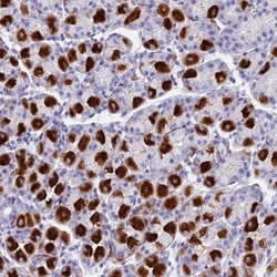 LYRM5 Antibody, Novus Biologicals 25 &mu;L, Unconjugated:Antibodies, Polyclonal