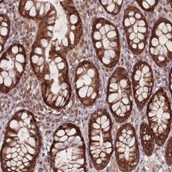 LYRM7 Antibody, Novus Biologicals 0.1mL; Unlabeled:Antibodies, Polyclonal