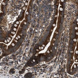 LYSMD3 Antibody, Novus Biologicals:Antibodies:Primary Antibodies