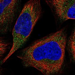 LZTFL1 Antibody, Novus Biologicals 0.1mL; Unlabeled:Antibodies, Polyclonal
