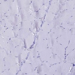 LZTFL1 Antibody, Novus Biologicals 0.1mL; Unlabeled:Antibodies, Polyclonal
