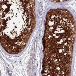 LZTFL1 Antibody, Novus Biologicals 0.1mL; Unlabeled:Antibodies, Polyclonal