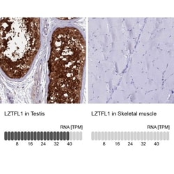 LZTFL1 Antibody, Novus Biologicals 0.1mL; Unlabeled:Antibodies, Polyclonal