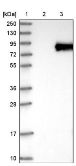 anti-LZTS1, Polyclonal, Novus Biologicals 0.1mL; Unlabeled:Antibodies,