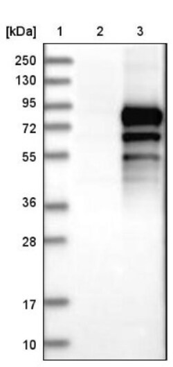 LZTS1 Antibody, Novus Biologicals:Antibodies:Primary Antibodies