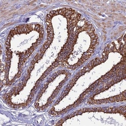 LZTS2 Antibody, Novus Biologicals:Antibodies:Primary Antibodies