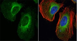 Lactate Dehydrogenase A/LDHA Antibody, Novus Biologicals 0.1 mL | Buy Online | Novus Biologicals | Fisher Scientific