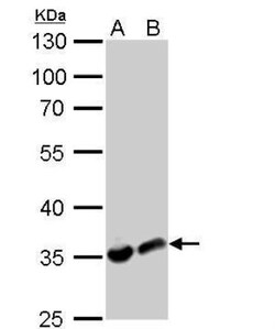 Lactate Dehydrogenase A/LDHA Antibody, Novus Biologicals 0.1 mL | Buy Online | Novus Biologicals | Fisher Scientific