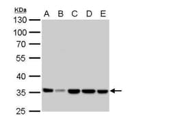 Lactate Dehydrogenase A/LDHA Antibody, Novus Biologicals 0.1 mL | Buy Online | Novus Biologicals | Fisher Scientific