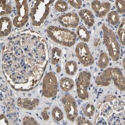Lactate Dehydrogenase B Antibody, Novus Biologicals 0.1mL; Unlabeled:Antibodies,