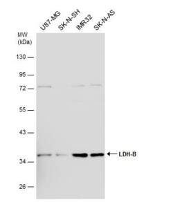 Lactate Dehydrogenase B Antibody, Novus Biologicals 0.1mL; Unlabeled:Antibodies,