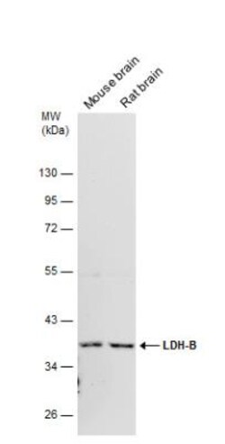 Lactate Dehydrogenase B Antibody, Novus Biologicals 0.1mL; Unlabeled:Antibodies,