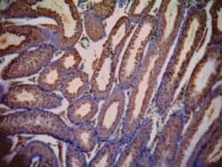 Lactate Dehydrogenase C Antibody, Novus Biologicals 0.1mg; Unlabeled:Antibodies,
