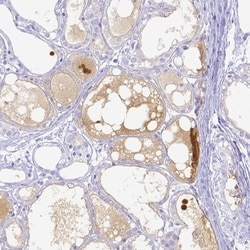 Lactoferrin Antibody, Novus Biologicals:Antibodies:Primary Antibodies