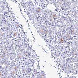 Lactoferrin Antibody, Novus Biologicals:Antibodies:Primary Antibodies