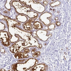 Lactoferrin Antibody, Novus Biologicals 25 &mu;L, Unlabeled:Antibodies,