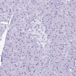 Lactoferrin Antibody, Novus Biologicals 25 &mu;L, Unlabeled:Antibodies,