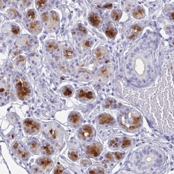 Lactoferrin Antibody, Novus Biologicals 25 &mu;L, Unlabeled:Antibodies,