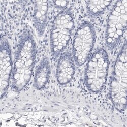 Apolipoprotein A-IV/ApoA4 Antibody, Novus Biologicals:Antibodies:Primary