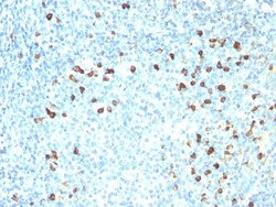 Lambda Light Chain Antibody (ICO-106), Novus Biologicals 0.2 mg | Buy Online | Novus Biologicals | Fisher Scientific