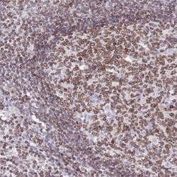 Lamin B Receptor Antibody, Novus Biologicals 25 &mu;L, Unlabeled:Antibodies,