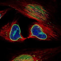 Lamin B1 Antibody (CL3929), Novus Biologicals:Antibodies:Primary Antibodies