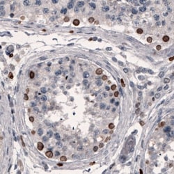 Lamin B1 Antibody (CL3929), Novus Biologicals:Antibodies:Primary Antibodies