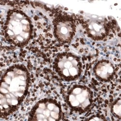 Lamin B1 Antibody (CL3929), Novus Biologicals:Antibodies:Primary Antibodies