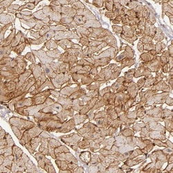 Laminin S/Laminin beta 2 Antibody, Novus Biologicals 25 &mu;L; Unlabeled:Antibodies,