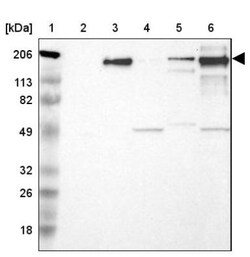 Laminin S/Laminin beta 2 Antibody, Novus Biologicals 25 &mu;L; Unlabeled:Antibodies,