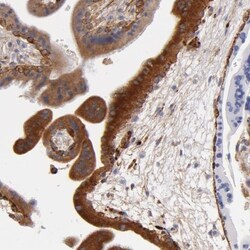 Laminin gamma 1 Antibody, Novus Biologicals 0.1mL; Unlabeled:Antibodies,