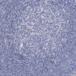 Laminin gamma 1 Antibody, Novus Biologicals 0.1mL; Unlabeled:Antibodies,
