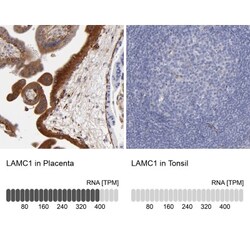 Laminin gamma 1 Antibody, Novus Biologicals 0.1mL; Unlabeled:Antibodies,