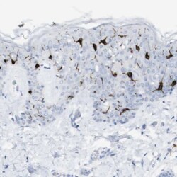 Langerin/CD207 Antibody, Novus Biologicals 25 &mu;L; Unlabeled:Antibodies,