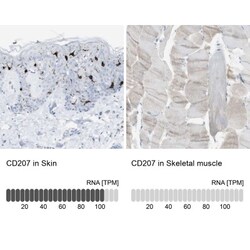 Langerin/CD207 Antibody, Novus Biologicals 25 &mu;L; Unlabeled:Antibodies,