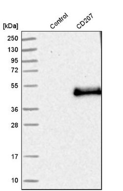Langerin/CD207 Antibody, Novus Biologicals 25 &mu;L; Unlabeled:Antibodies,
