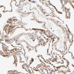 Latent TGF-beta bp2/LTBP-2 Antibody, Novus Biologicals 25 &mu;L; Unlabeled:Antibodies,