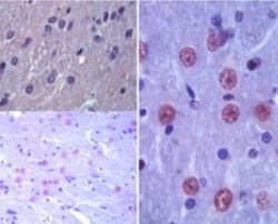 Latexin Antibody, Novus Biologicals 0.1mL; Unlabeled:Antibodies, Polyclonal