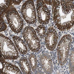 Latrophilin 3/LPHN3 Antibody, Novus Biologicals:Antibodies:Primary Antibodies