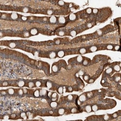 Latrophilin 3/LPHN3 Antibody, Novus Biologicals 25 &mu;L; Unlabeled:Antibodies,