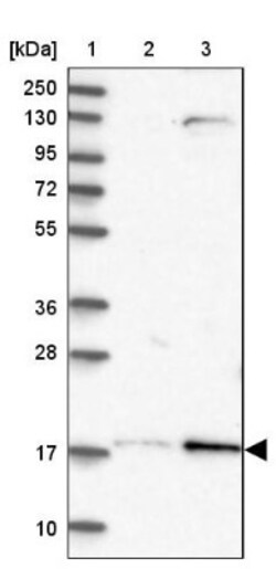 Layilin Antibody, Novus Biologicals 0.1mL; Unlabeled:Antibodies, Polyclonal