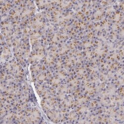 Legumain/Asparaginyl Endopeptidase Antibody, Novus Biologicals 0.1mL; Unlabeled:Antibodies,