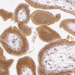 Legumain/Asparaginyl Endopeptidase Antibody, Novus Biologicals 0.1mL; Unlabeled:Antibodies,