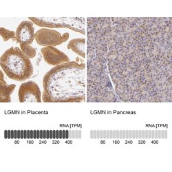Legumain/Asparaginyl Endopeptidase Antibody, Novus Biologicals 0.1mL; Unlabeled:Antibodies,